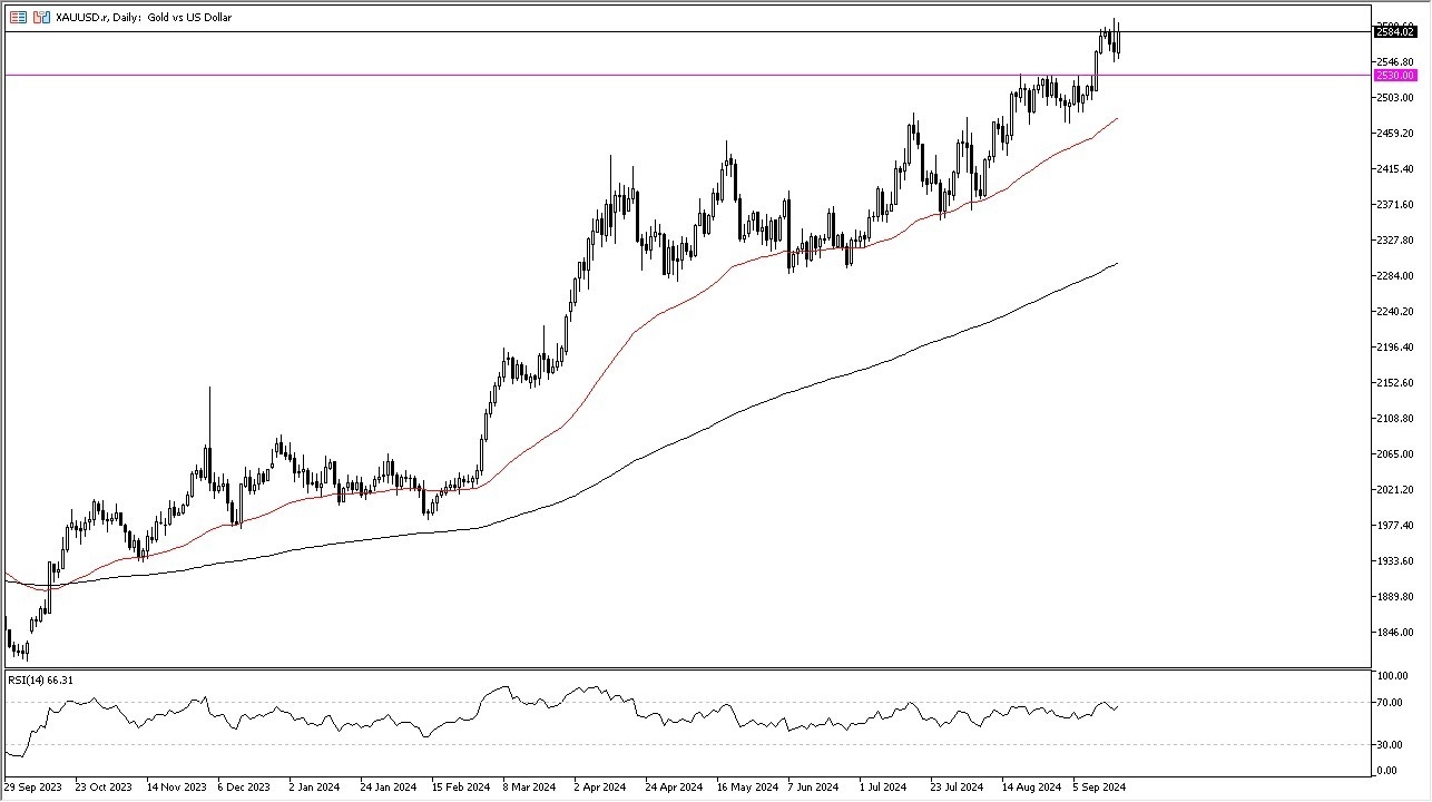 Gold Forecast Today 20/9: Attracts Attention (graph)